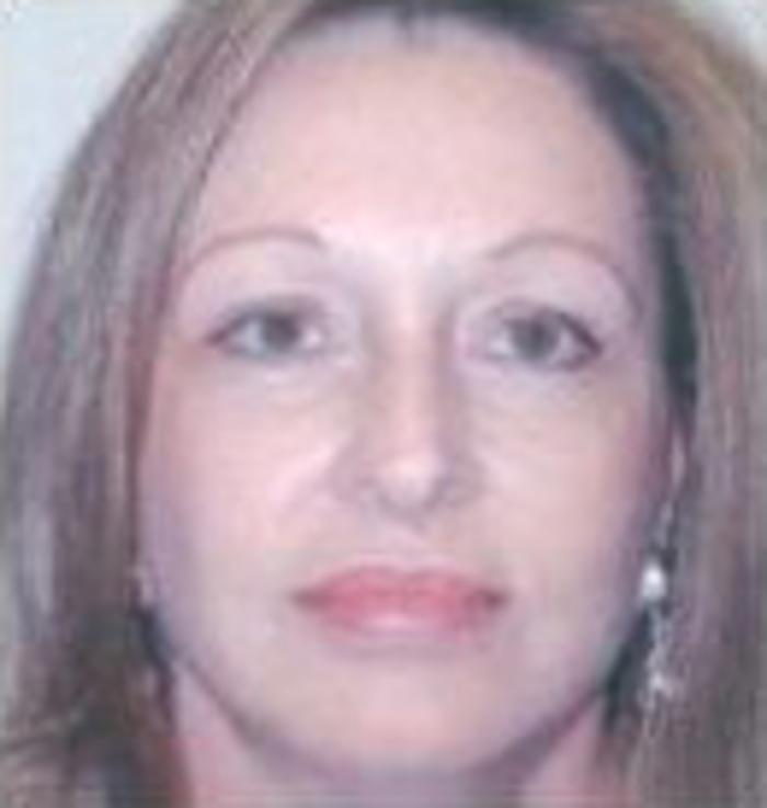 Before & After Facelift Case 5759 View 1 View in Houston, TX