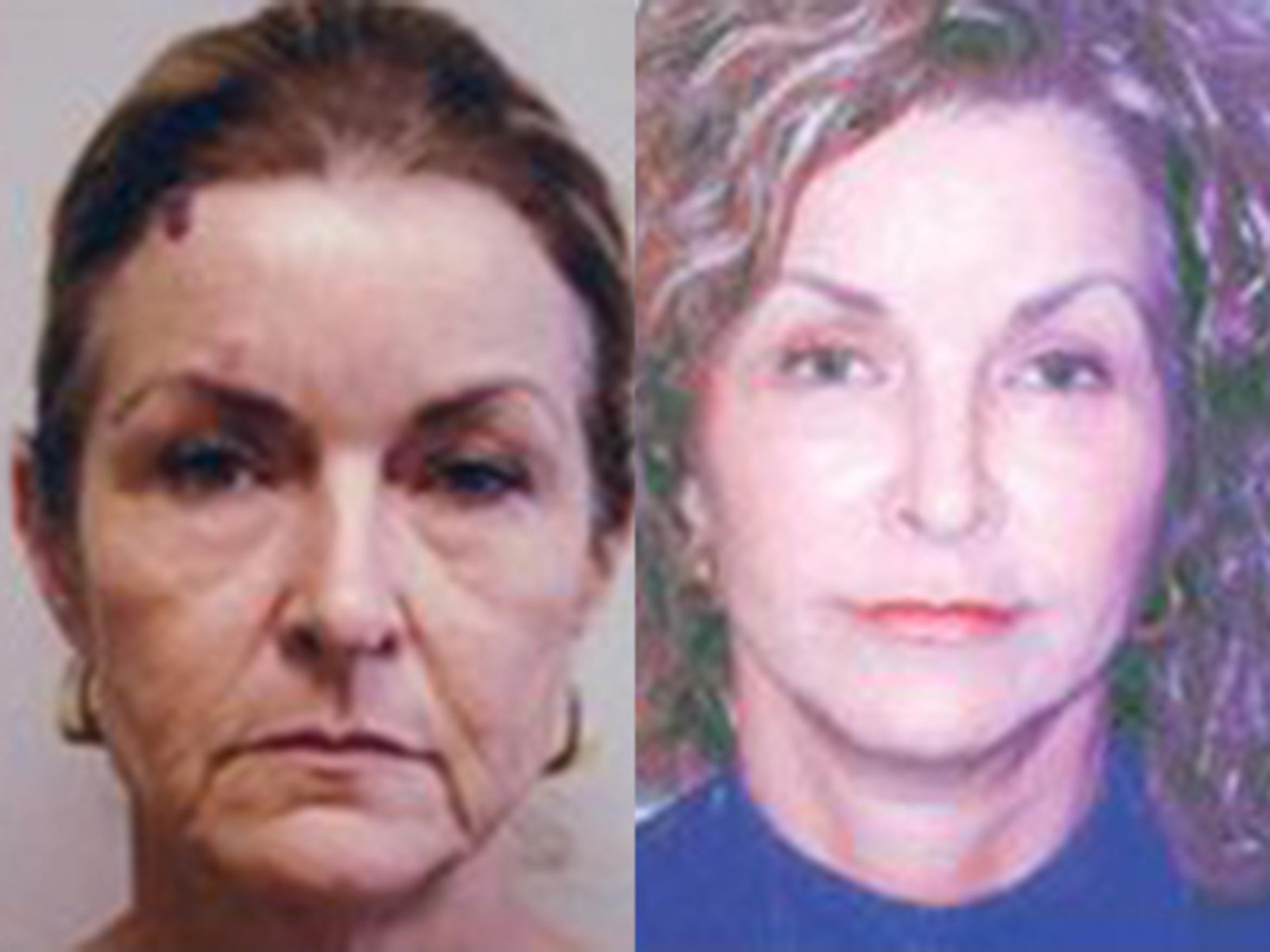 Before & After Facelift Case 5769 View 1 View in Houston, TX